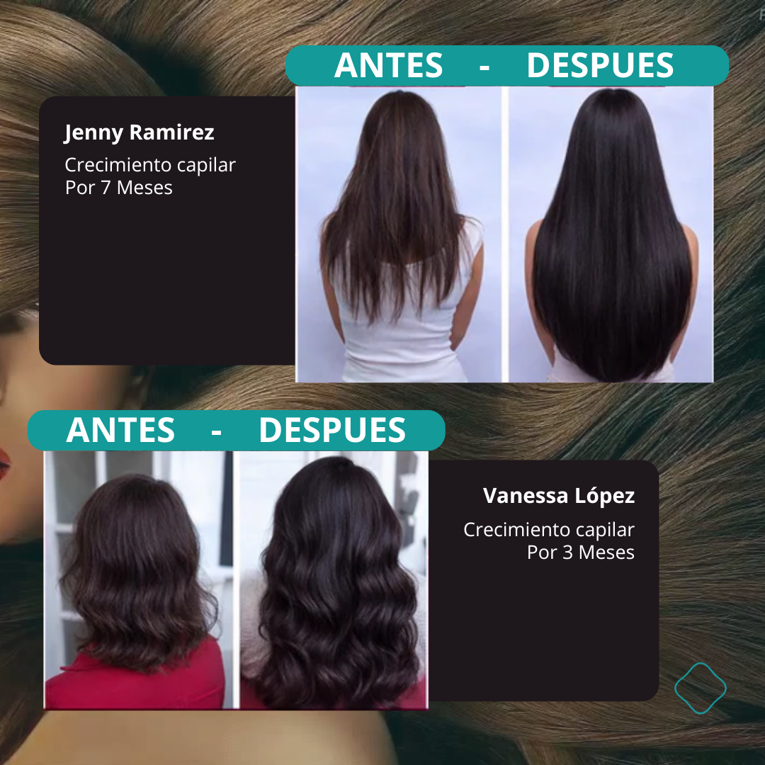 FOLIXA™ Trifolic Hair Complex - Biotina + Colágeno Hidrolizado + Zinc + Vitaminas Esenciales