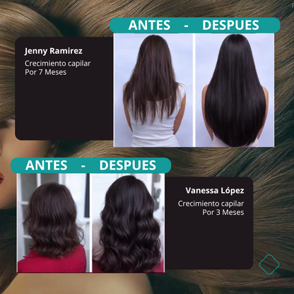 FOLIXA™ Trifolic Hair Complex - Biotina + Colágeno Hidrolizado + Zinc + Vitaminas Esenciales