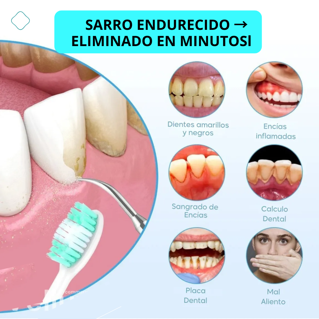 SonicWhite™ - Limpiador Dental por Ultrasonido Pro