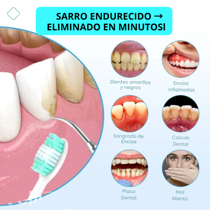 SonicWhite™ - Limpiador Dental por Ultrasonido Pro